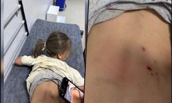 7 yaşındaki çocuğa 3 sokak köpeği saldırdı