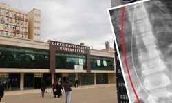 Dicle Üniversitesi’nde ihmal iddiası:  Küçük çocuğun kalbinde kateter unutulmuş
