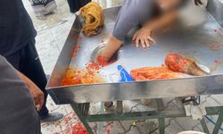 Şanlıurfa'da salça makinesine elini kaptıran genç kız ameliyatla kurtarıldı