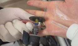 Parmağa sıkışan yüzüğü itfaiye çıkardı