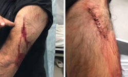 Şanlıurfa'da öğretmene jiletli saldırı