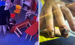Diyarbakır’da özel okulda korkutan ihmal: 3 yaşındaki çocuğun parmakları ezildi