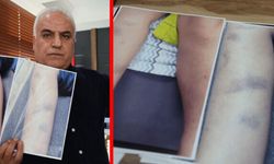 Diyarbakır’da "okula gitmek istemiyorum" diyen çocuğun arkasından şiddet çıktı