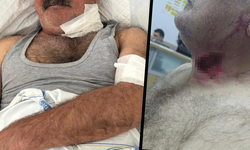 Diyarbakır’da at saldırısı: Sahibini ağır yaraladı