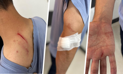 Diyarbakır Gazi Yaşargil Hastanesi'nde doktor ve tıbbi sekretere saldırı