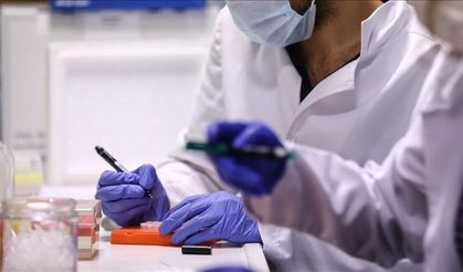 30 yıl sonra yeniden hortladı: Veba laboratuardan mı yayıldı?