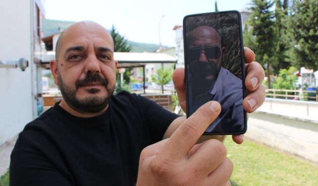 Üzerindeki 25 keneyi selfie sayesinde fark etti