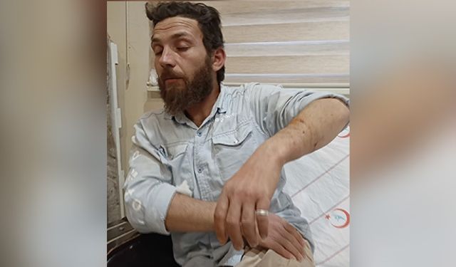Yolda yürürken köpek saldırısına uğradı