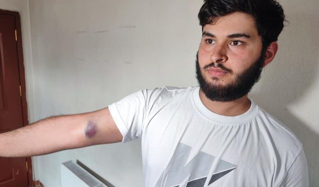 ‘Top’ kavgası kabusa döndü: Hamile kadına bile saldırdılar