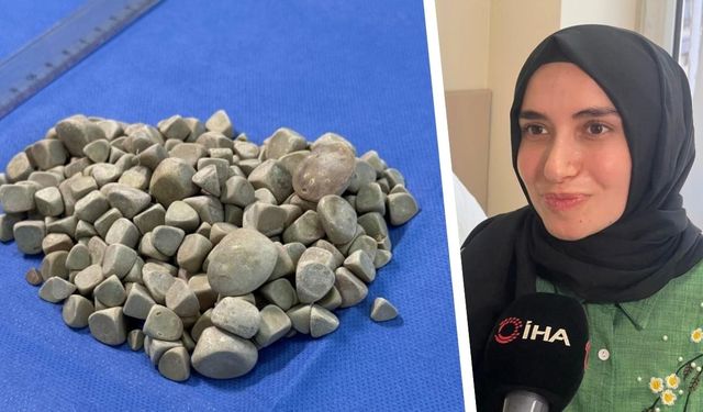 Doktorlar şok oldu; Genç kızın vücudundan 287 tane taş çıkarıldı