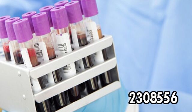 KAN GAZI TESTLERİ ALIMI YAPILACAK
