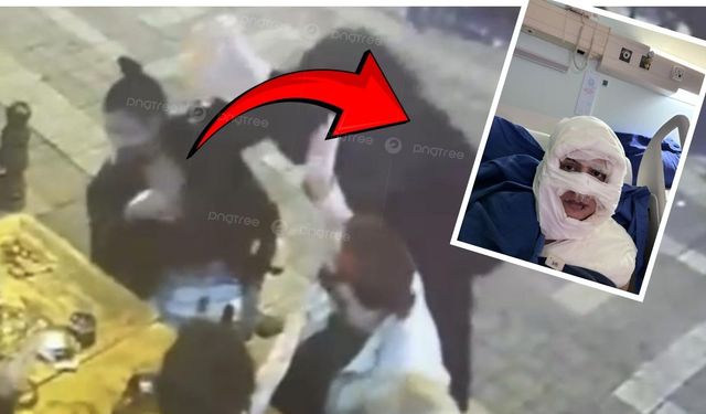 Akıl almaz olay: Genç kadın, benzinle ateşe verildi