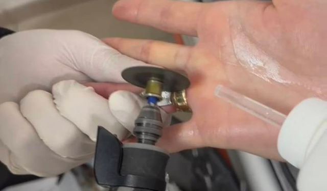 Parmağa sıkışan yüzüğü itfaiye çıkardı