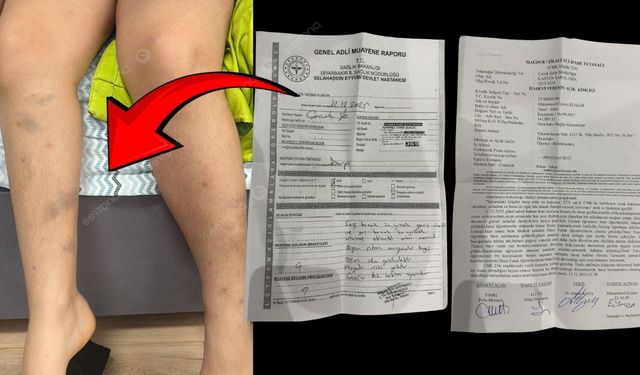 Diyarbakır'da özel okulda öğretmen şiddeti; 8 yaşındaki çocuk darp edildi