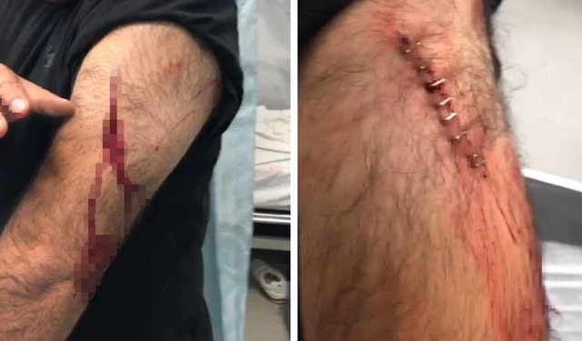 Şanlıurfa'da öğretmene jiletli saldırı