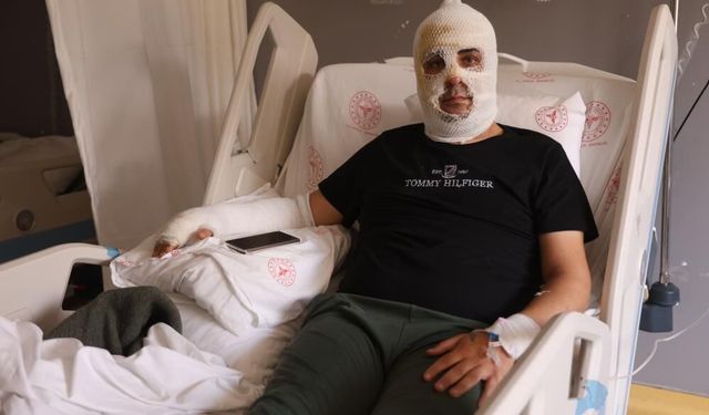 Ekmek teknesini kurtarmak için kendini yaktı