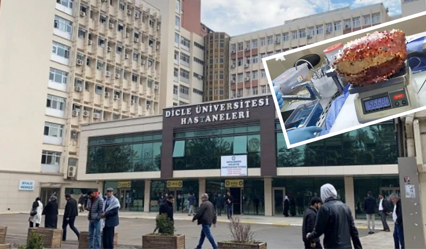 Diyarbakır’da, hastanın bacağından dev kitle çıkarıldı