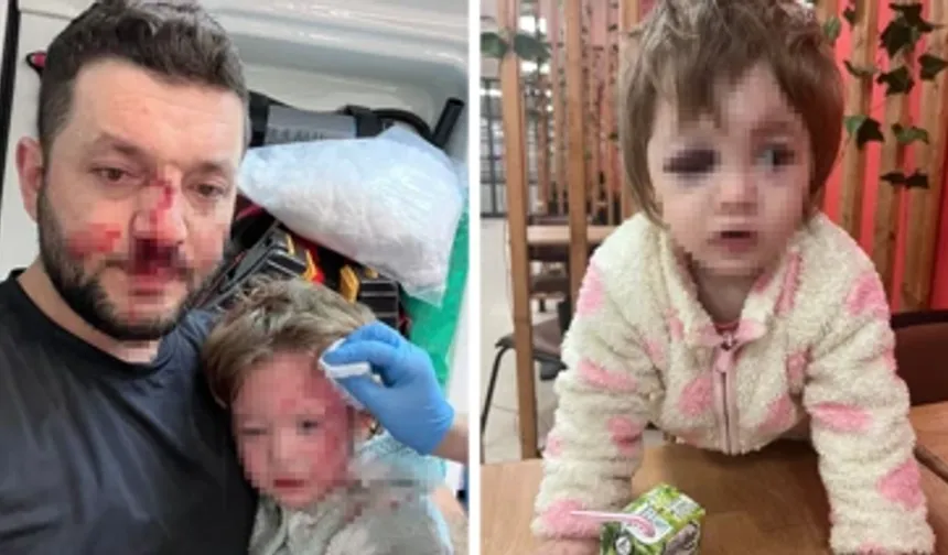 Komşu dehşeti! 14 aylık bebeğin kafatası çatladı, baba hastanelik oldu