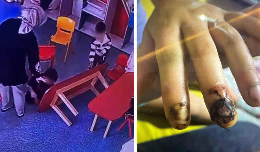 Diyarbakır’da özel okulda korkutan ihmal: 3 yaşındaki çocuğun parmakları ezildi