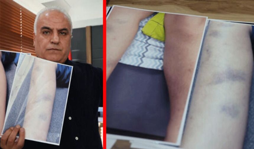 Diyarbakır’da "okula gitmek istemiyorum" diyen çocuğun arkasından şiddet çıktı