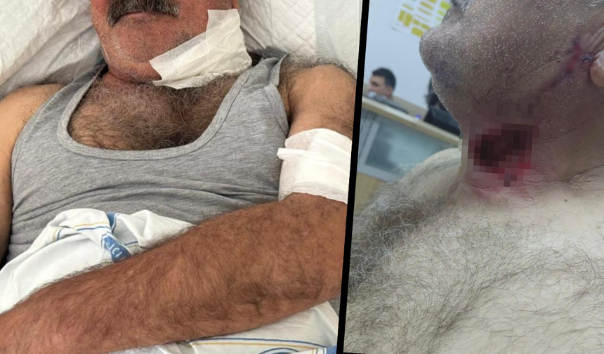 Diyarbakır’da at saldırısı: Sahibini ağır yaraladı