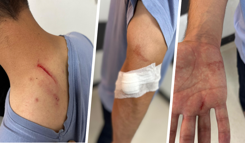 Diyarbakır Gazi Yaşargil Hastanesi'nde doktor ve tıbbi sekretere saldırı