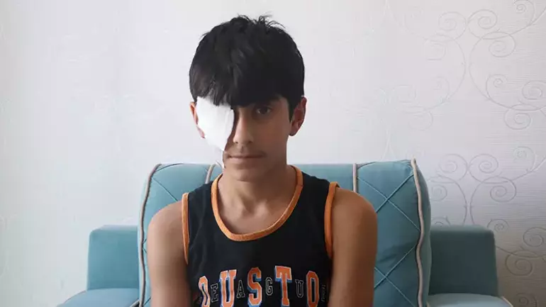 Yapıştırıcı Gözkapağı2